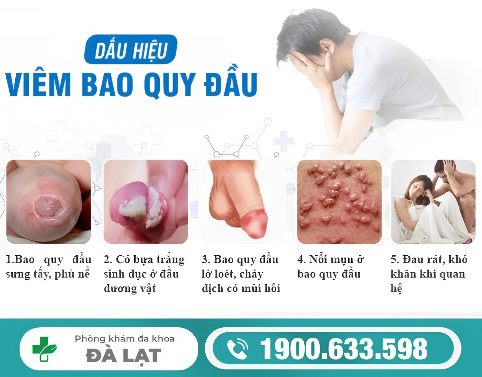 Hình ảnh minh họa